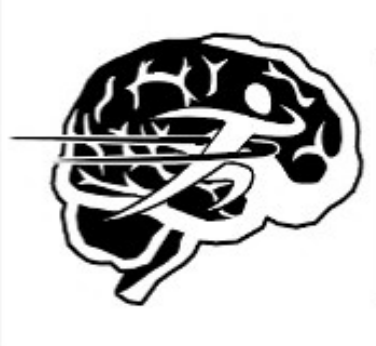 A person running swiftly is depicted in black and white over a cartoon of a brain